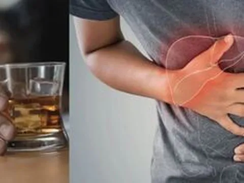 Chỉ số tổn thương gan cao gấp 18 lần sau 3 ngày liên tiếp 'nhậu vì công việc'