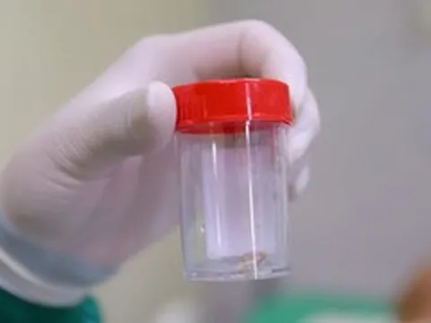 Ho khò khè kéo dài, sụt gần 20 kg, bất ngờ khi bác sĩ tìm ra nguyên nhân