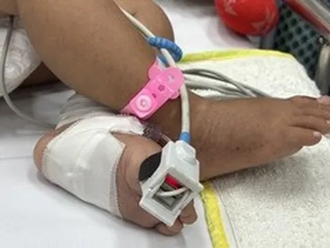 Nhiều trẻ sốt xuất huyết nặng, suy đa tạng tại TP.HCM