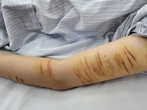 Trẻ vị thành niên và hành vi tự gây thương tích: Đừng để mạng xã hội thay thế kết nối gia đình