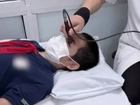 Nam sinh 13 tuổi vỡ nhãn cầu sau cú bật ô của bạn học