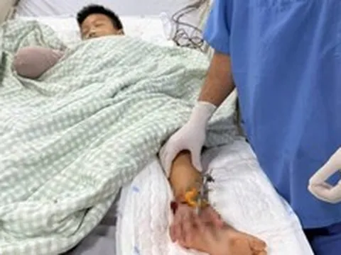 Cổng làng đổ sập đè bé trai 8 tuổi: Bác sĩ tạm nối bàn tay vào chân