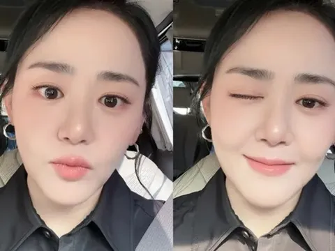 Nhan sắc 'em gái quốc dân' Moon Geun Young sau khi giảm cân