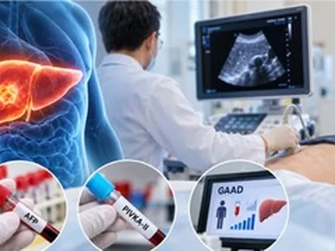 Năm nào cũng siêu âm vẫn không phát hiện ung thư gan, bác sĩ chỉ lý do