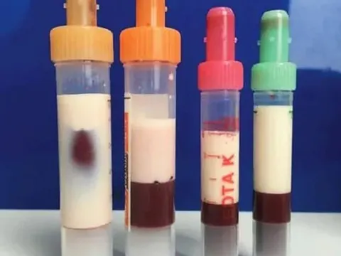 Bé gái 12 tuổi máu "trắng đục như sữa" vì thường xuyên ăn món quen thuộc "vạn người mê"