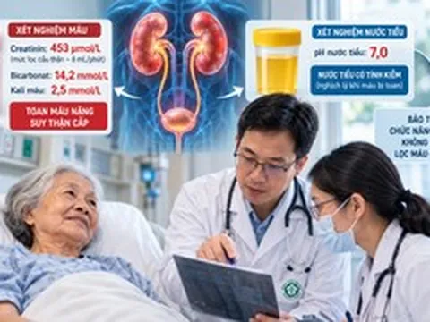 Cụ bà ung thư phổi mắc biến chứng hiếm, thế giới ghi nhận dưới 15 ca