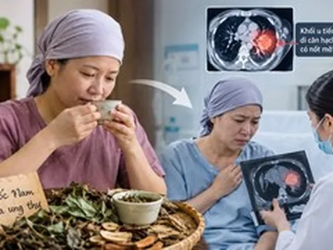 Bỏ phác đồ của bác sĩ để uống thuốc Nam chữa ung thư, 6 tháng sau đã di căn